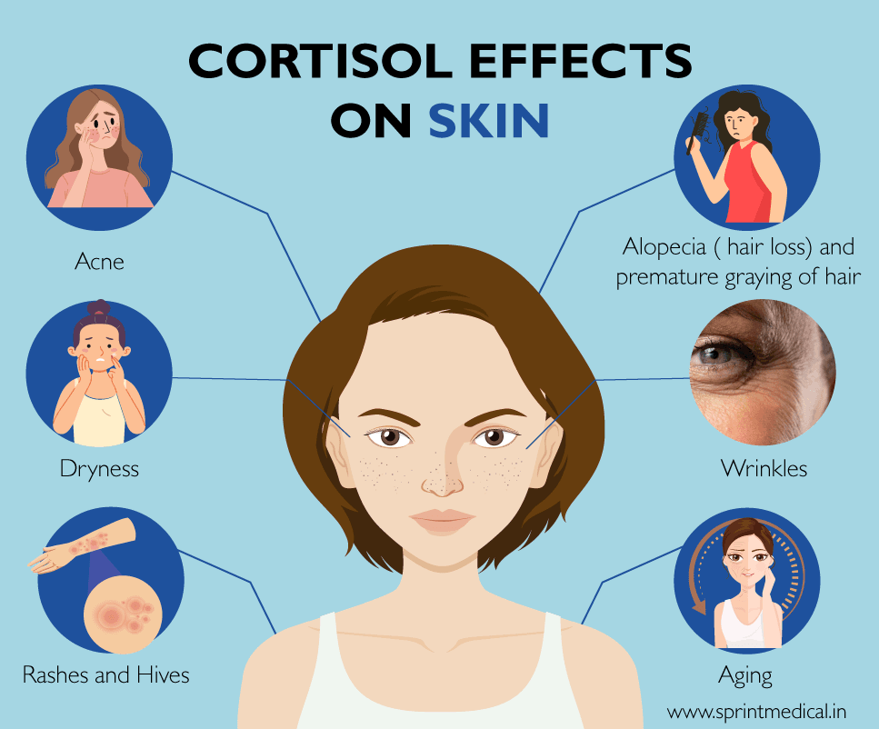 Cortisol Face: Can Stress Really Change Your Skin?